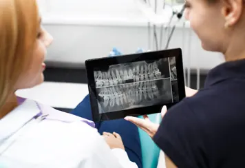Dental-Implants Dental implants at UV Dental