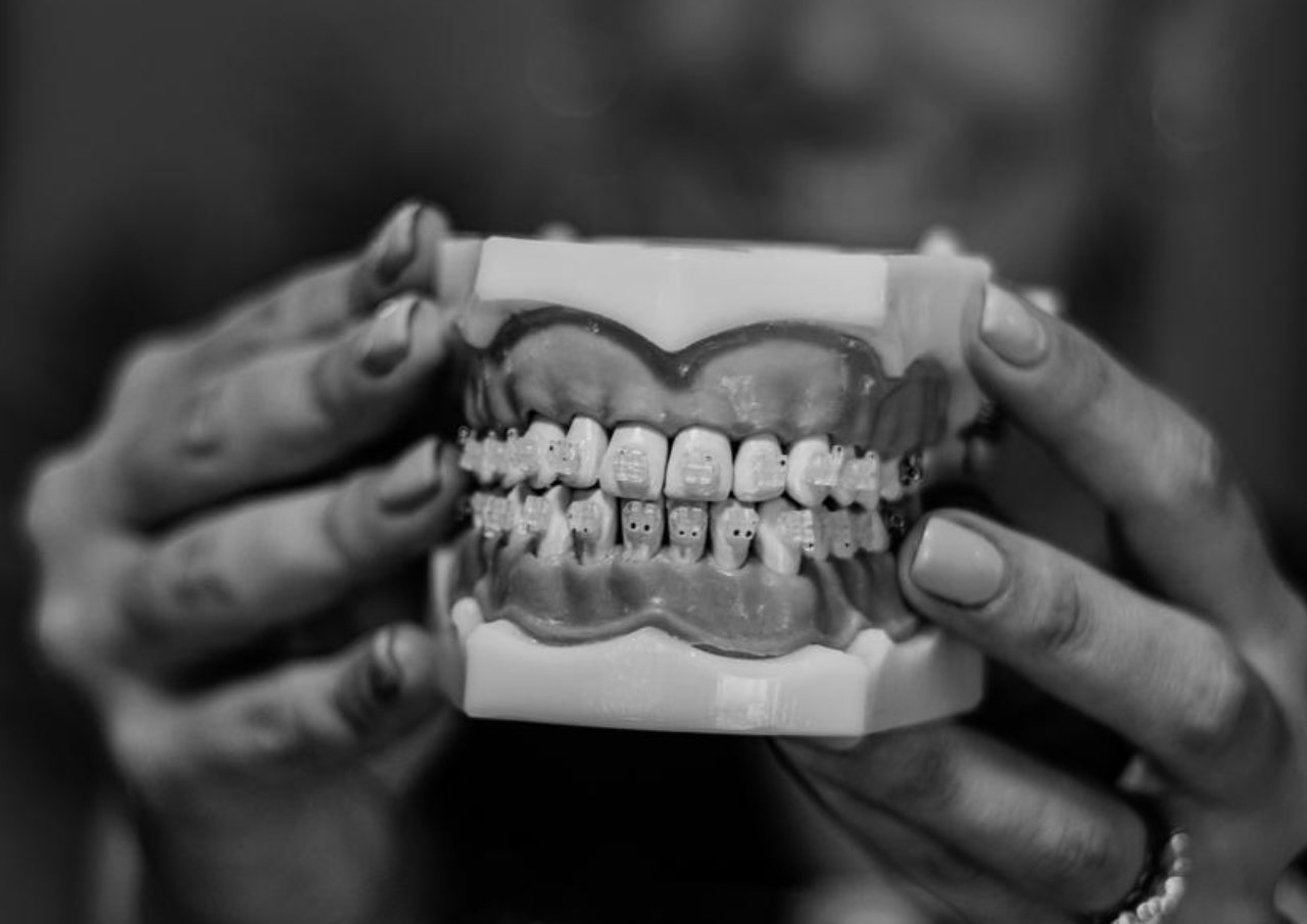 Orthodontics at UV Dental
